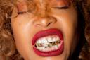 Erykah Badu showing her gold grill