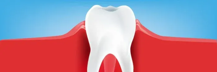 Hvad er årsagen til sygdom i tandkødet?  article banner