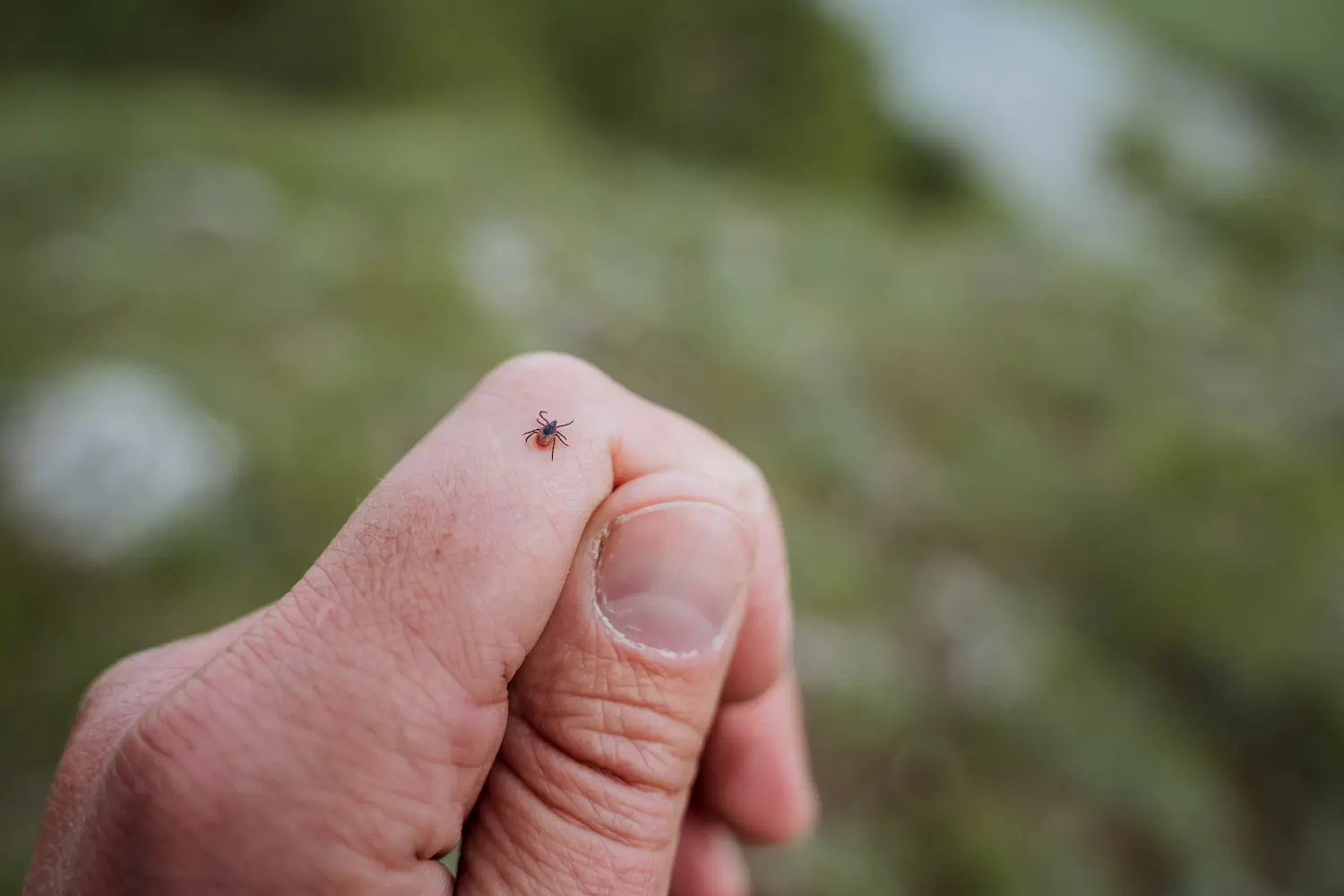 Tick on a man's finger