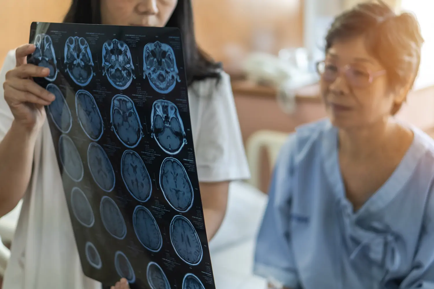 A patient asking her doctor what the common signs of stroke are