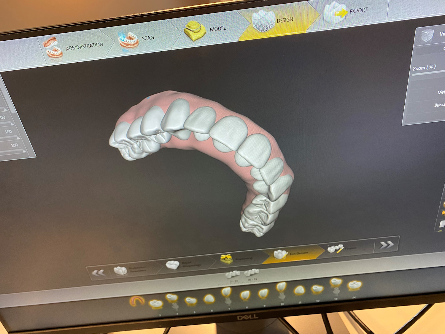 CAD design of full arch all on x replace teeth