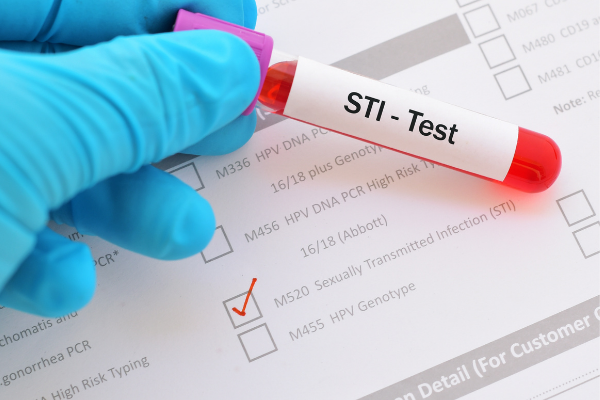 Where can I get tested for an STI?