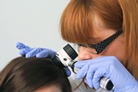 Dermatologist examining patient with alopecia areata
