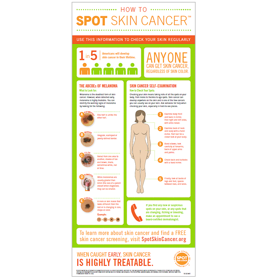 Infographic: How To SPOT Skin Cancer™