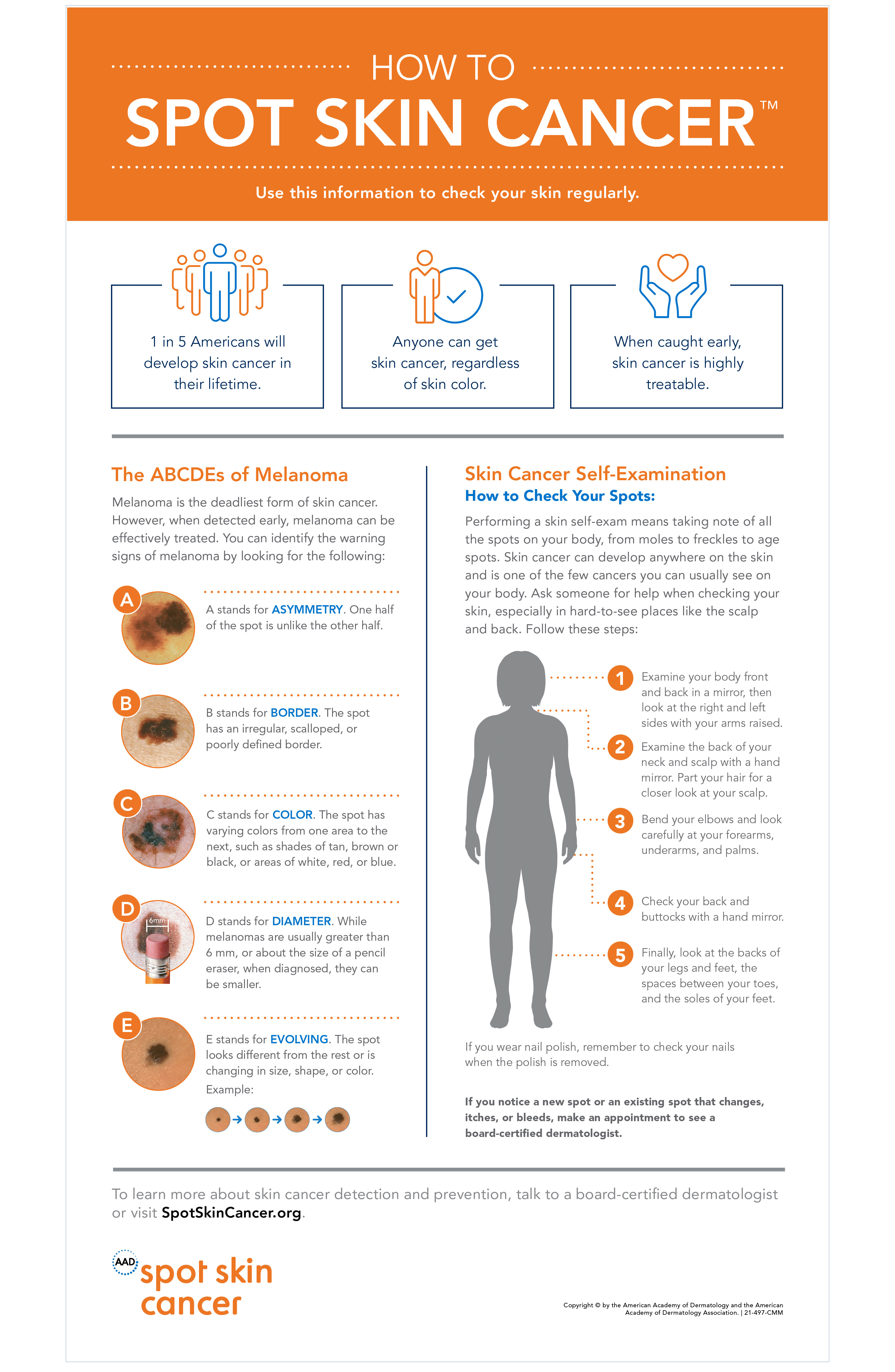 Use the information in this infographic to check your skin regularly.