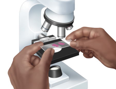 Biopsy under microscope medical illustration