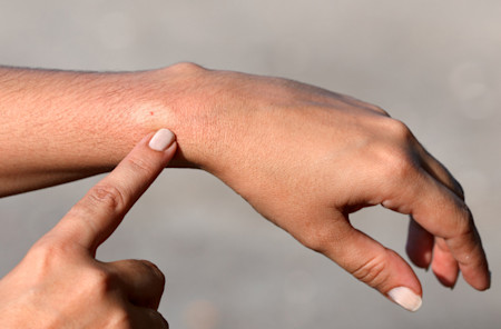 Hand pointing to a person's wrist where they have a bee sting.
