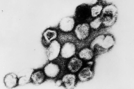 Rubella image