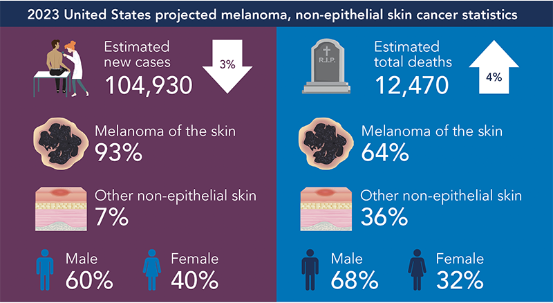 2023 United States projected melanoma graph