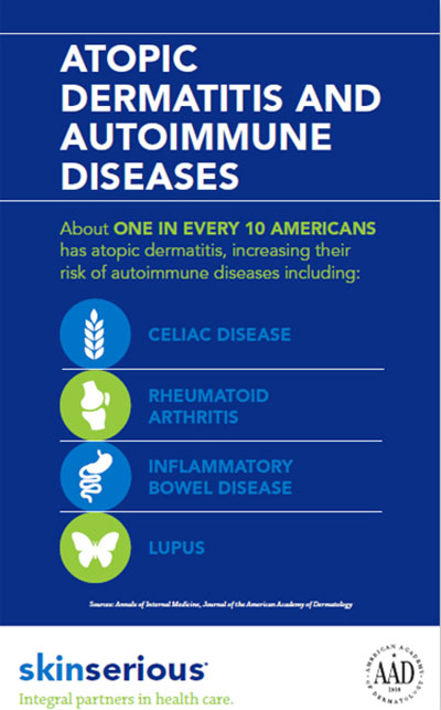 atopic dermatitis infographic