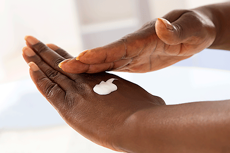 Woman with diabetes applying cream to her hands