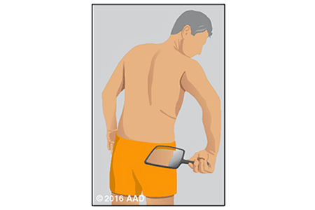 Illustration of a person holding a hand mirror checking his back and buttocks for signs of skin cancer