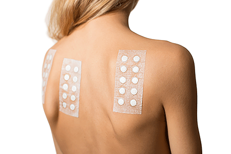 Patch testing on woman’s back