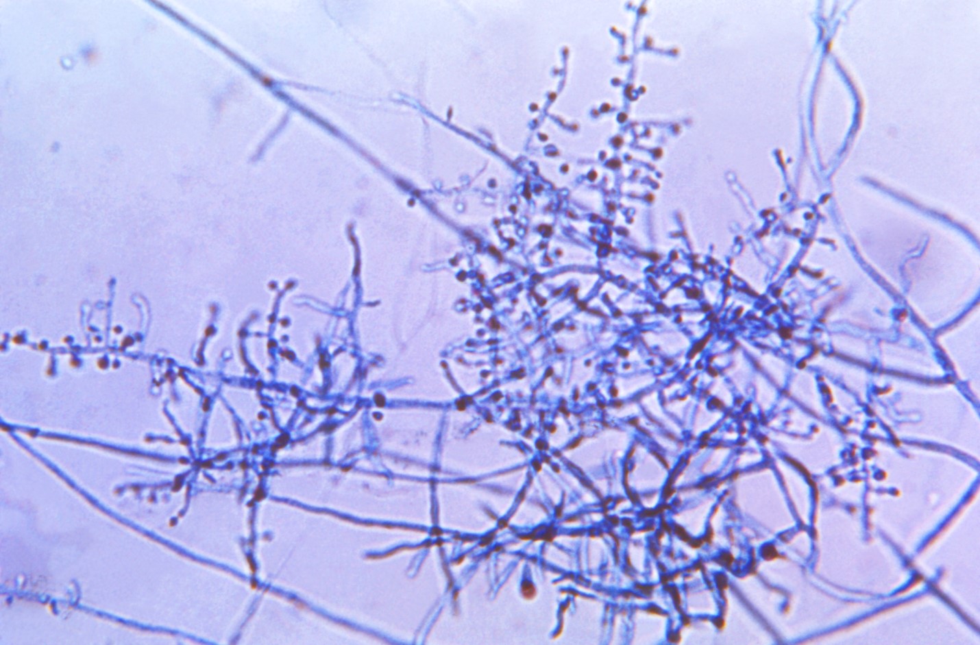 Under a magnification of 475X, this photomicrograph revealed some of the ultrastructural morphology exhibited by the dermatophytic fungal organism, Trichophyton mentagrophytes