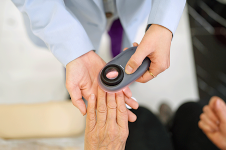 Dermatologist using a dermatoscope to exam patients’ nails for signs of lichen planus