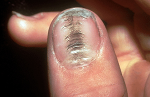 Washboard nails