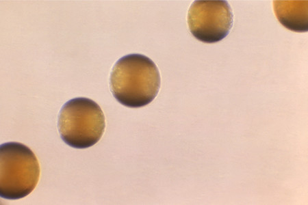 Meningococcal disease