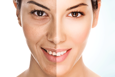 Model face is divided in two parts - aging on the left and younger on the right