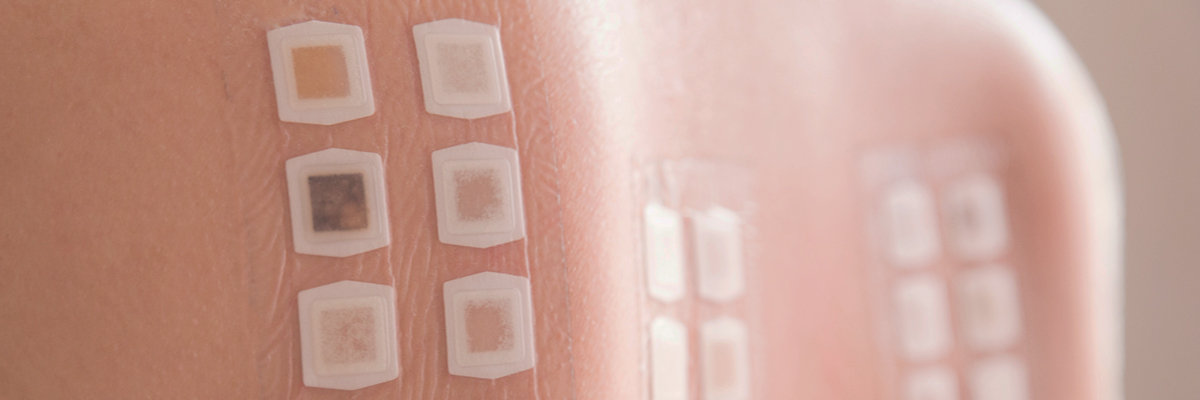 Illustration for Advocacy — Improving access to patch testing units