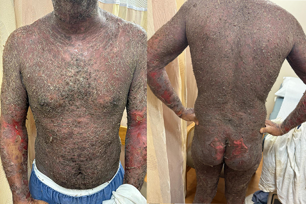 Race for the Case Spring 2026