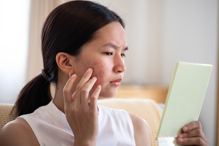 Woman worry about her face when she saw the problem of acne inflammation and scar by the mini mirror