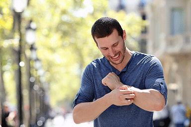 Adult man scratching itchy arm while standing outside