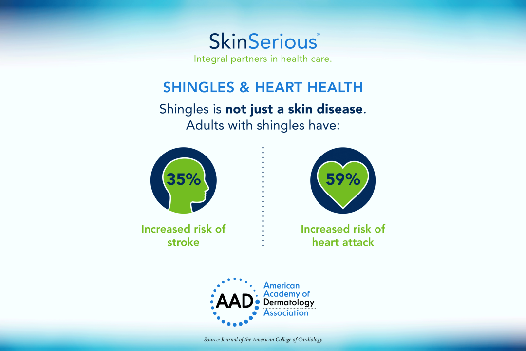 shingles infographic
