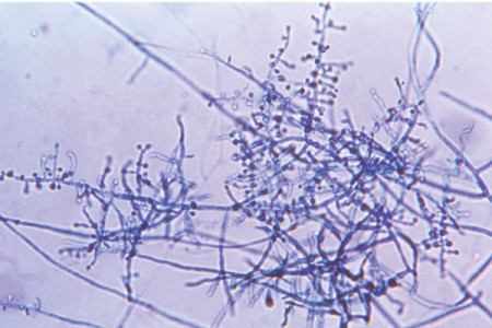 Card image of a dermatophyte