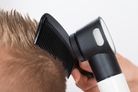 Dermatologist using a dermatoscope and comb to examine a patient for signs of alopecia areata