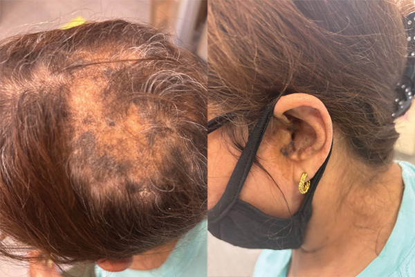 Race for the Case Winter 2025