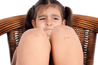 Little girl with bumps on her knees