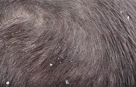 Close-up of dandruff on the scalp
