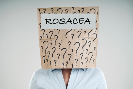 What is rosacea?