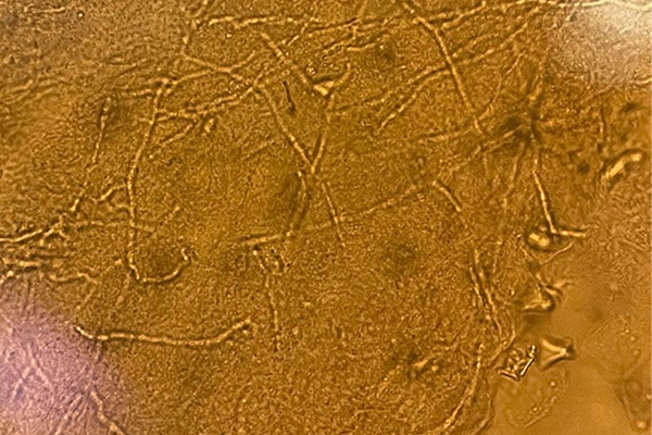 Trichophyton mentagrophytes