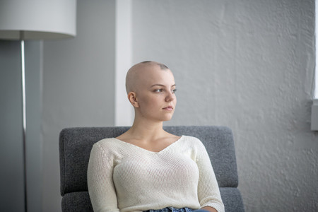 Young woman with Alopecia areata