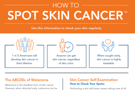 How to SPOT Skin Cancer infographic