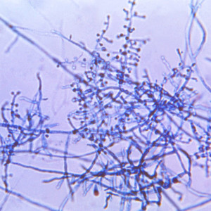 Card image for Recognizing Trichophyton indotineae