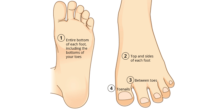 Illustration of how to check feet for signs of melanoma