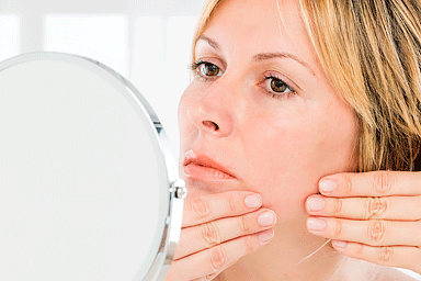 adult acne treatment