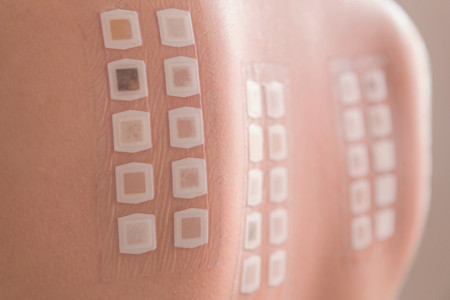 Card art for Advocacy — Improving access to patch testing units