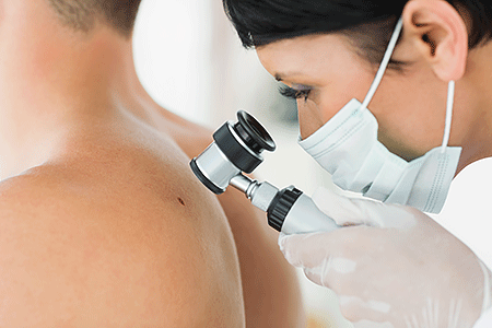 Close-up of dermatologist examining mole on back of male patient