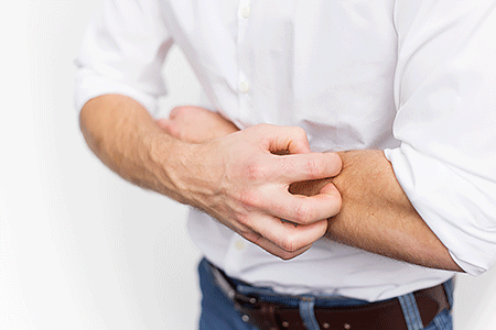 Man scratching itchy forearm