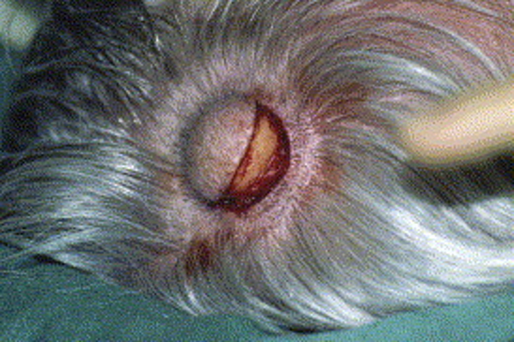 Image for DWII article on pilar cysts
