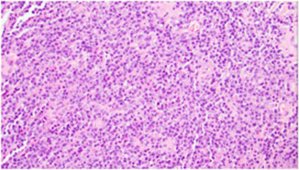 This image is from JAAD Case Reports 2025; 66: 80-83. 
