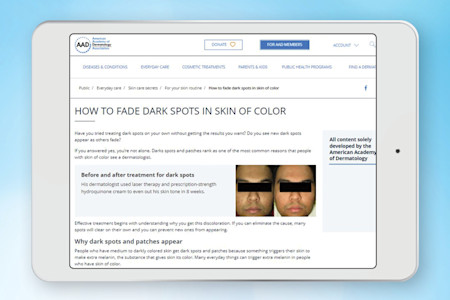 Card art for Educating the public — New content positions dermatologists as the experts