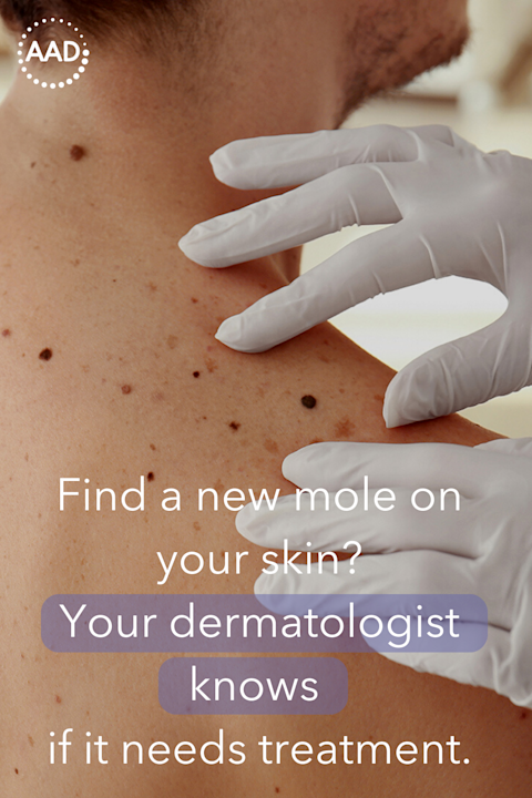 Card illustration for Your Dermatologist Knows