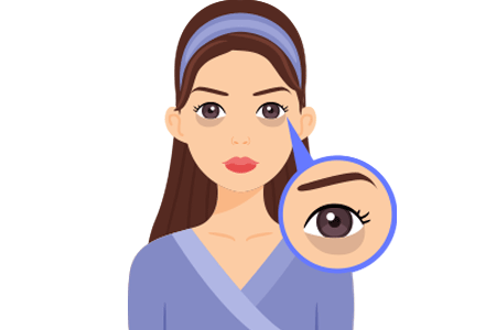Illustration of woman with loose skin under her eyes