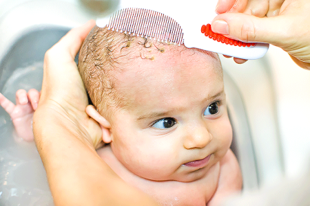 Carefully using a baby comb during a bath to help remove cradle cap scale in hair.