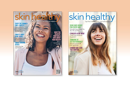 Card image of skin healthy magazine