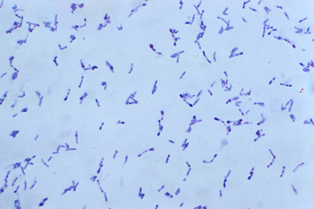 Cutaneous diptheria image